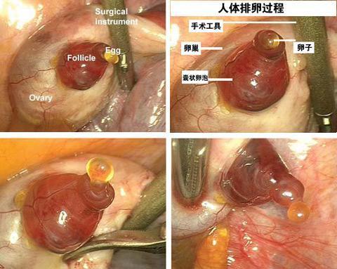 比利时妇科医生首次拍得珍贵的人类排卵照片 图 资讯 凤凰网