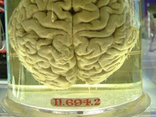 eBay网上拍卖墨索里尼大脑 起拍价1.5万欧元(