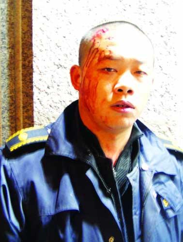 3名小贩持砖砸破城管头 群众劝说未果报警