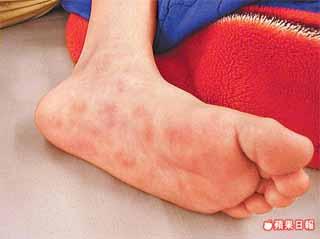 台湾7龄童接种甲流疫苗后因败血症夭折(图)