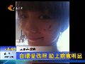 王珞丹微博自曝受伤照 脸上疤痕明显