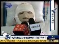 合肥毁容少女含泪控诉：我回不去了