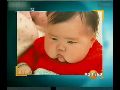 【2004年5月】安徽毒奶粉曝光 大头娃娃震惊国人