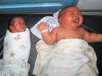 印尼产妇生下8.7公斤重巨婴 创该国纪录[图集]
