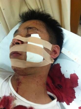 王老吉业务员被砍致重伤 再次与加多宝员工上演全武行
