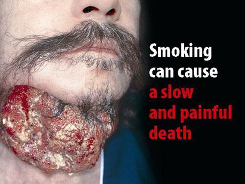 抽烟的危害图片恐怖图片