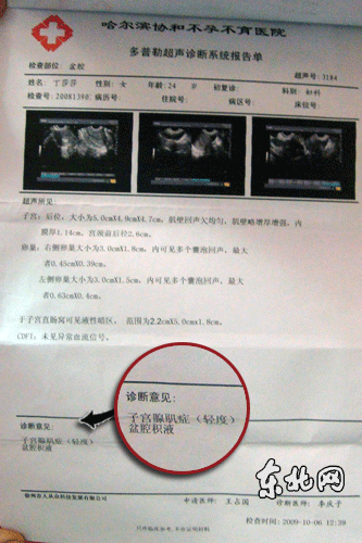 宫颈糜烂检查报告图片