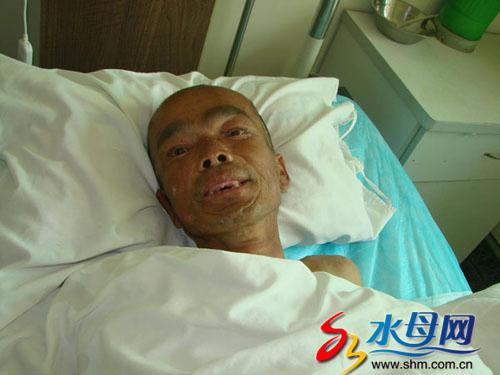 尿毒症男子遭家人遗弃路边浑身腐烂含恨咽气