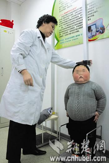 重度小胖墩辗转求减肥专家助其开始减肥图