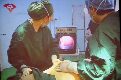 变性人手术器官图片